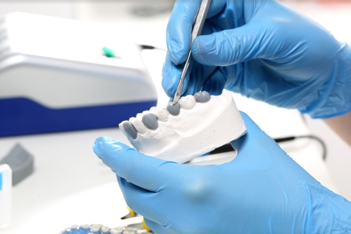 Protesi Dentale: preparazione e applicazione del provvisorio in resina | Studio Mario Lisa