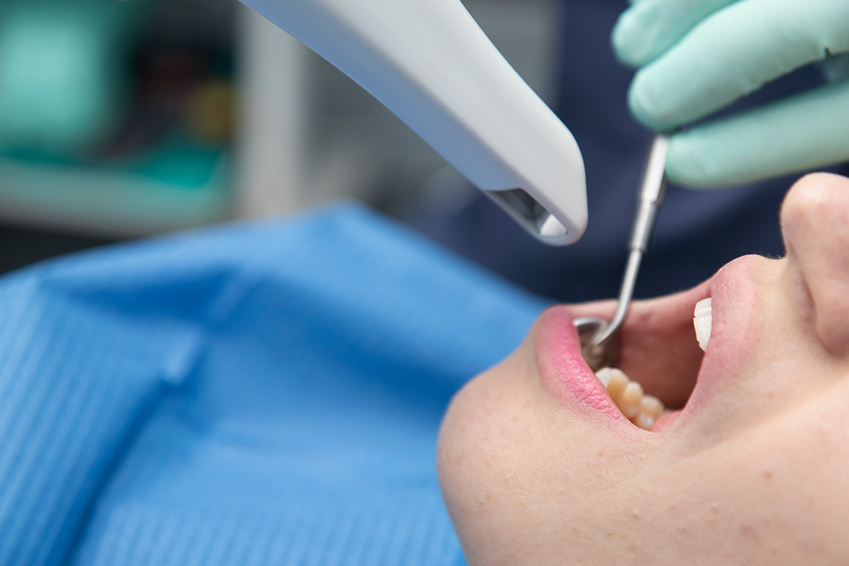 Metodi di riparazione intraorale di protesi fisse: procedure tecniche e  cliniche Protocolli di riparazione adesiva di protesi fisse